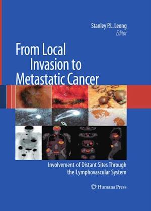 From Local Invasion to Metastatic Cancer