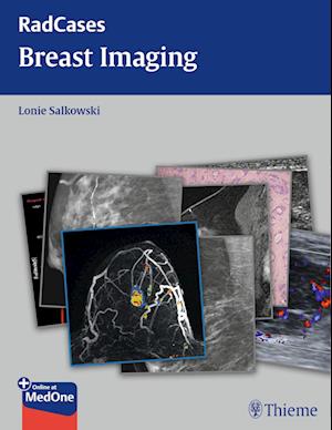 Breast Imaging