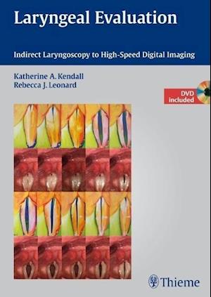 Laryngeal Evaluation : Indirect Laryngoscopy to High-Speed Digital Imaging