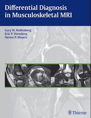 Differential Diagnosis in Musculoskeletal MR Autoren