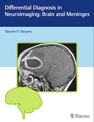 Differential Diagnosis in Neuroimaging