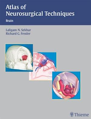 Atlas of Neurosurgical Techniques