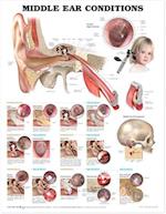 Middle Ear Conditions Anatomical Chart