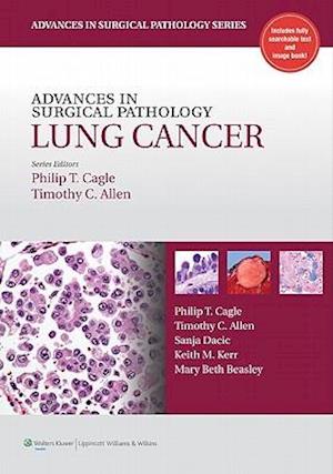 Advances in Surgical Pathology: Lung Cancer