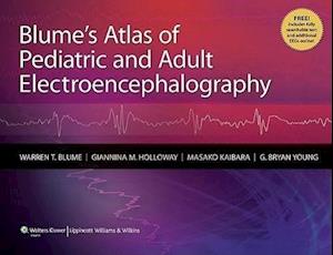 Blume's Atlas of Pediatric and Adult Electroencephalography