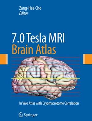 7.0 Tesla MRI Brain Atlas