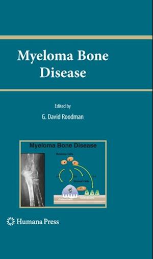 Myeloma Bone Disease