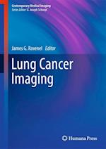 Lung Cancer Imaging