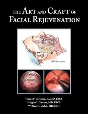 Art and Craft of Facial Rejuvenation