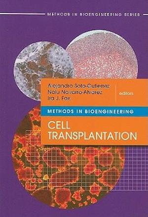 Cell Transplantation