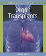 Organ Transplants