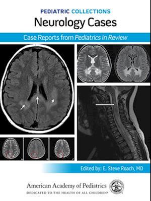 Pediatric Collections