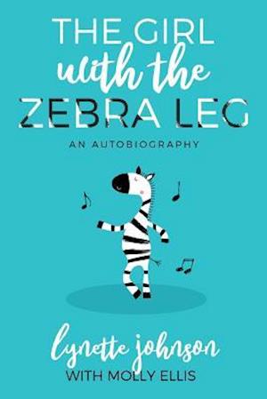 The Girl with the Zebra Leg