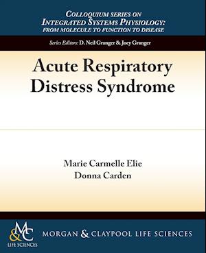 Acute Respiratory Distress Syndrome