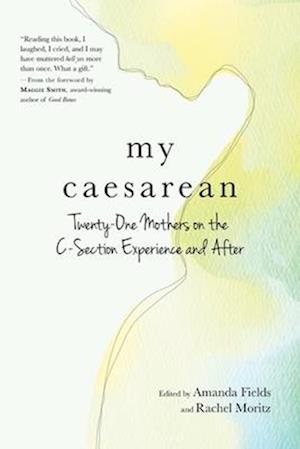 My Caesarean