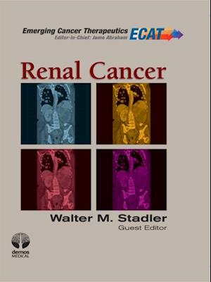 Renal Cancer