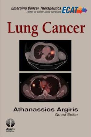 Lung Cancer