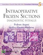 Intraoperative Frozen Sections