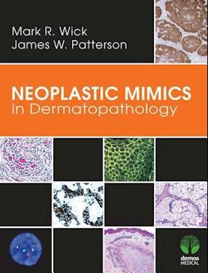 Neoplastic Mimics in Dermatopathology