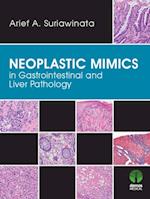 Neoplastic Mimics in Gastrointestinal and Liver Pathology