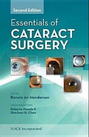 Essentials of Cataract Surgery