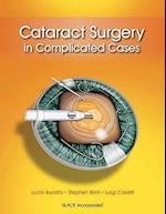 Cataract Surgery in Complicated Cases