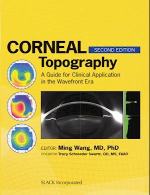 Corneal Topography