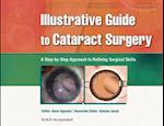 Illustrative Guide to Cataract Surgery