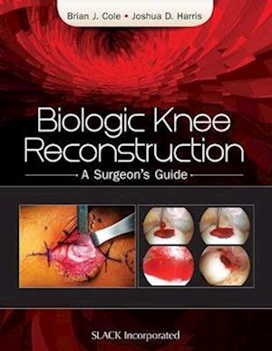 Biologic Knee Reconstruction