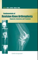 Fundamentals of Revision Knee Arthroplasty