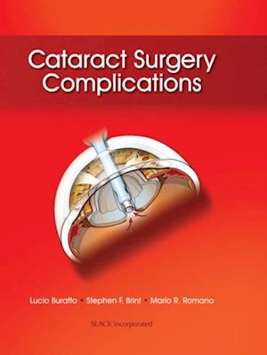 Cataract Surgery Complications