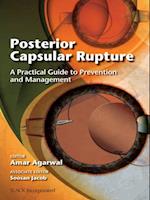 Posterior Capsular Rupture