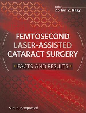 Femtosecond Laser-Assisted Cataract Surgery