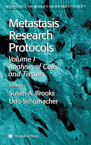 Metastasis Research Protocols