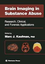 Brain Imaging in Substance Abuse