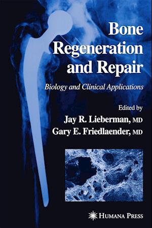 Bone Regeneration and Repair