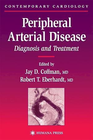 Peripheral Arterial Disease