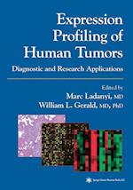 Expression Profiling of Human Tumors