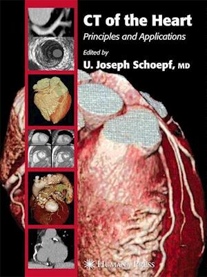 CT of the Heart