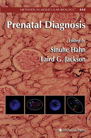 Prenatal Diagnosis