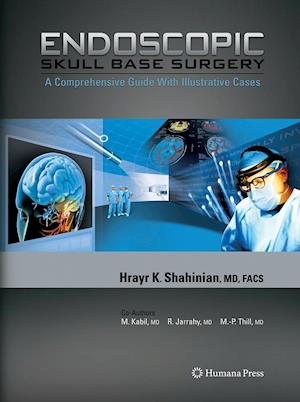 Endoscopic Skull Base Surgery