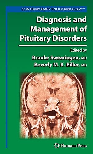 Diagnosis and Management of Pituitary Disorders