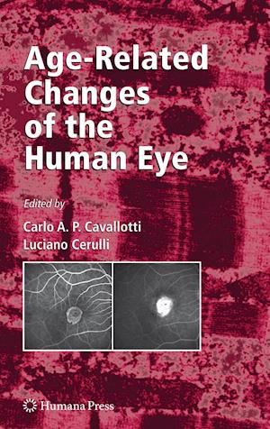 Age-Related Changes of the Human Eye