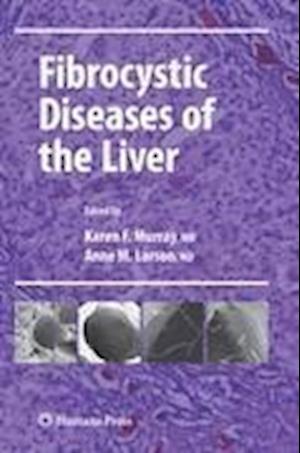 Fibrocystic Diseases of the Liver