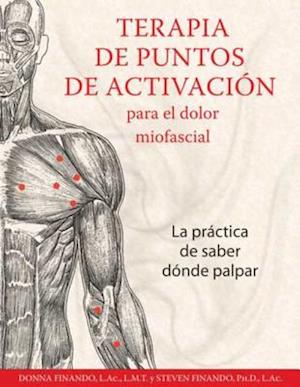 Terapia de puntos de activación para el dolor miofascial