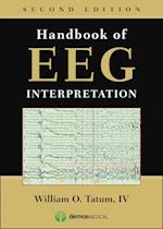 Handbook of Eeg Interpretation, Second Edition