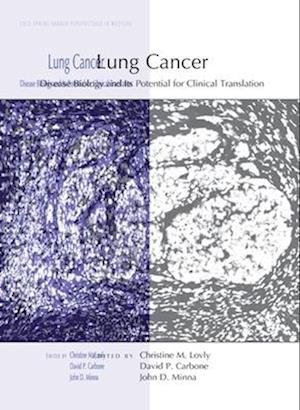 Lung Cancer