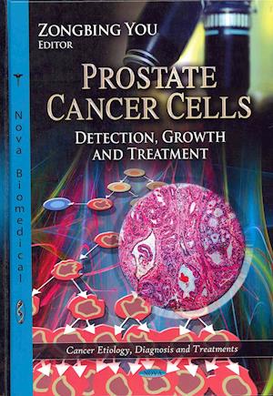 Prostate Cancer Cells