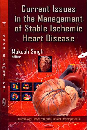 Current Issues in the Management of Stable Ischemic Heart Disease