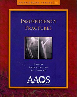Insufficiency Fractures